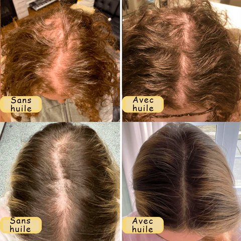 Huile naturelle de croissance des cheveux