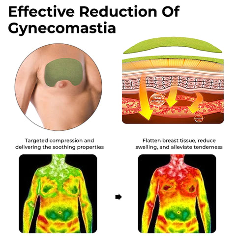 Patch de compresse pour gynécomastie Oveallgo