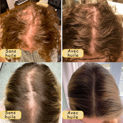 Huile naturelle de croissance des cheveux